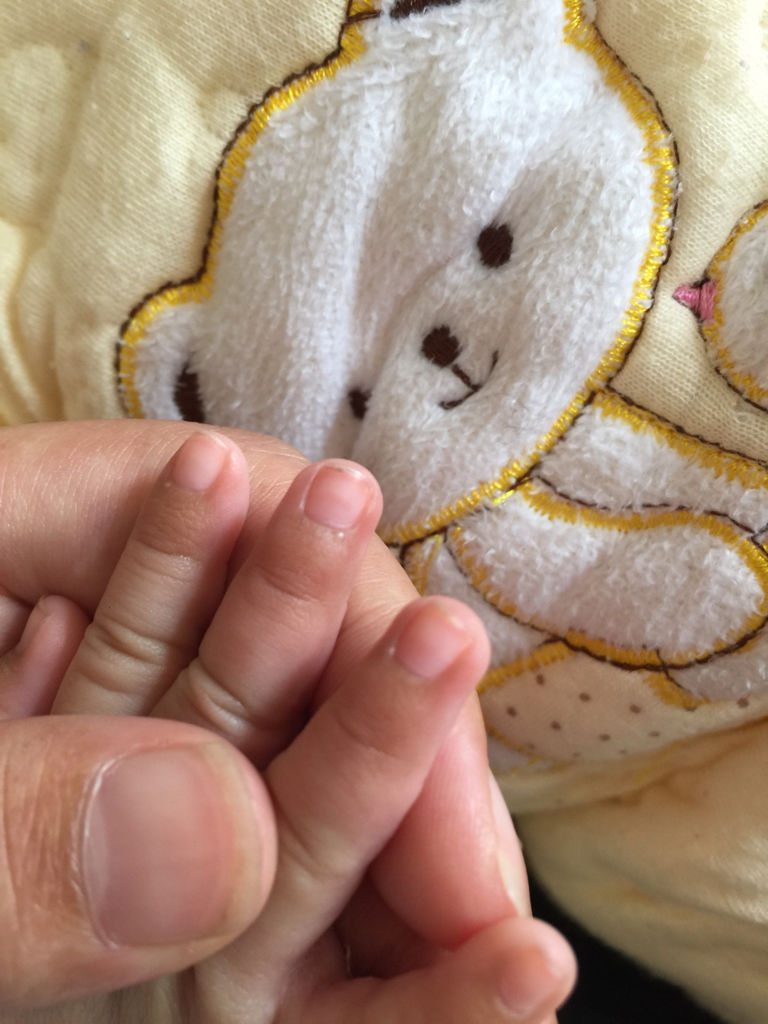 婴儿指甲根部发紫怎么回事 婴儿指甲根部轻微发紫正常吗